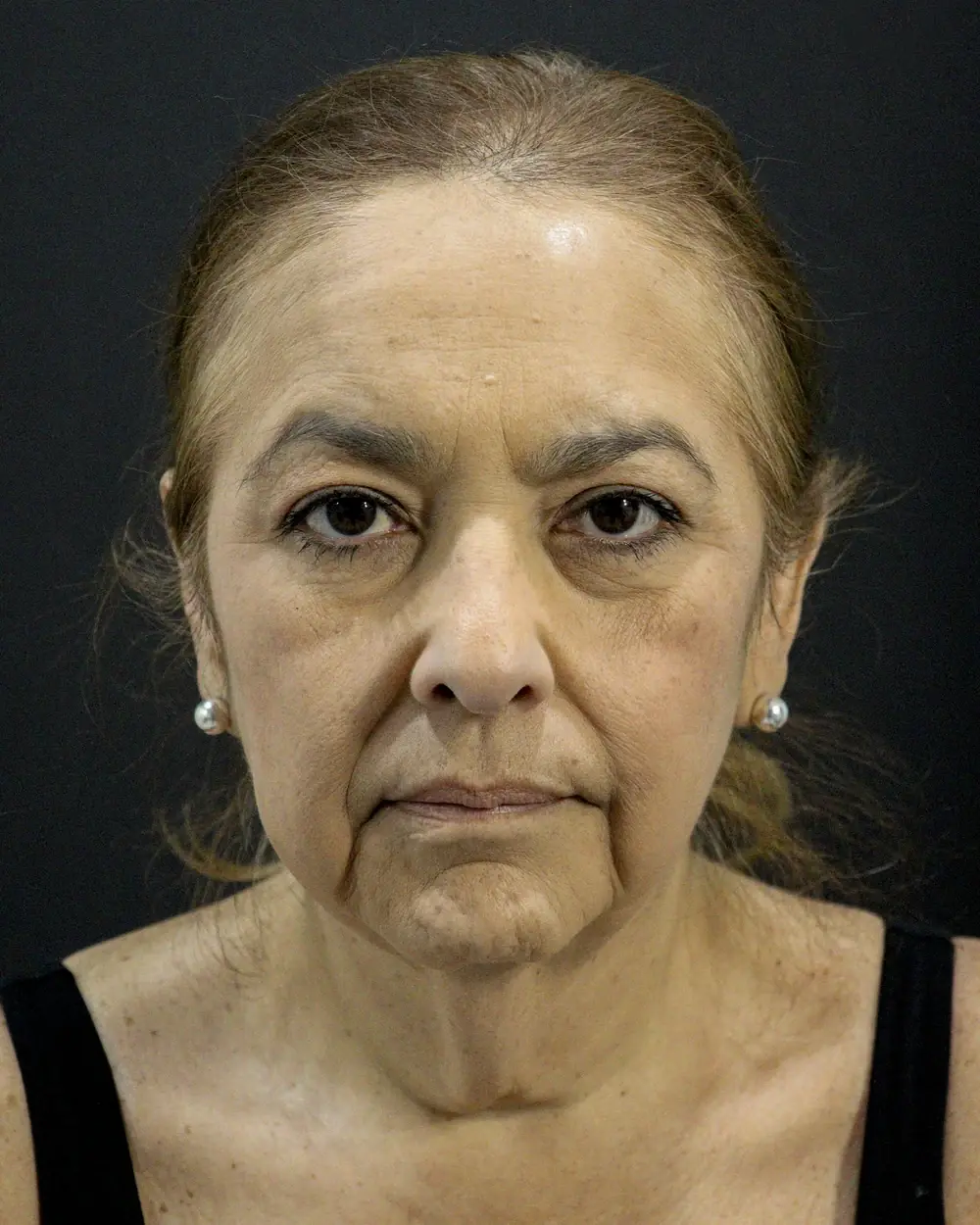 A neck before surgery