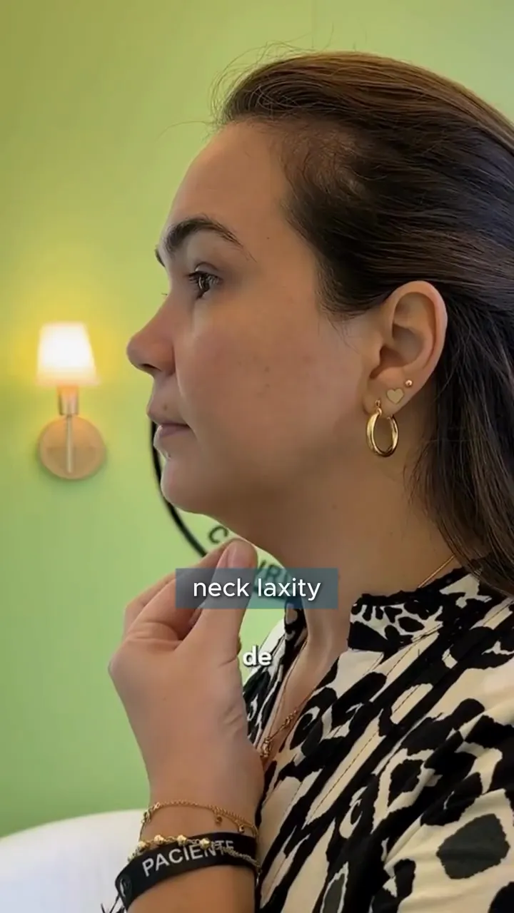Dr. Quiroz on choosing between chin liposuction and a neck lift